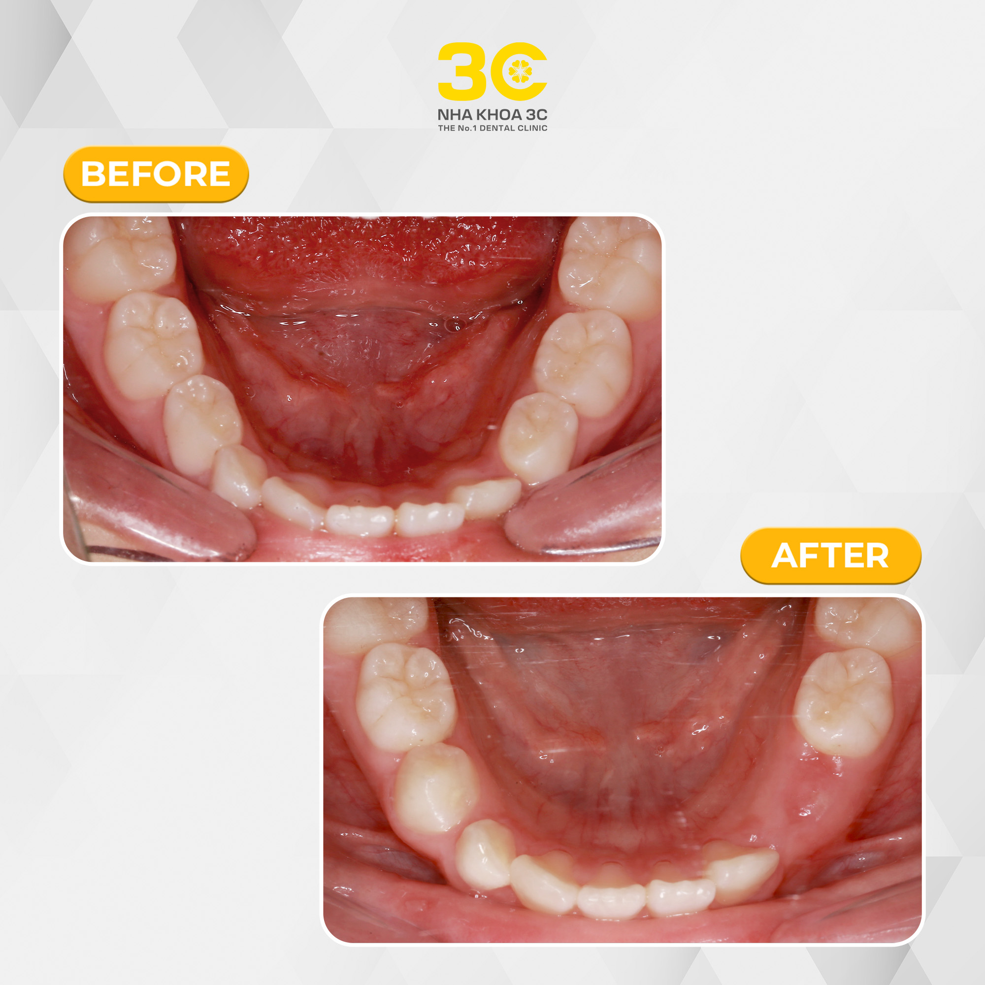 NHA KHOA 3C - DỊCH VỤ NHA KHOA UY TÍN TẠI TPHCM