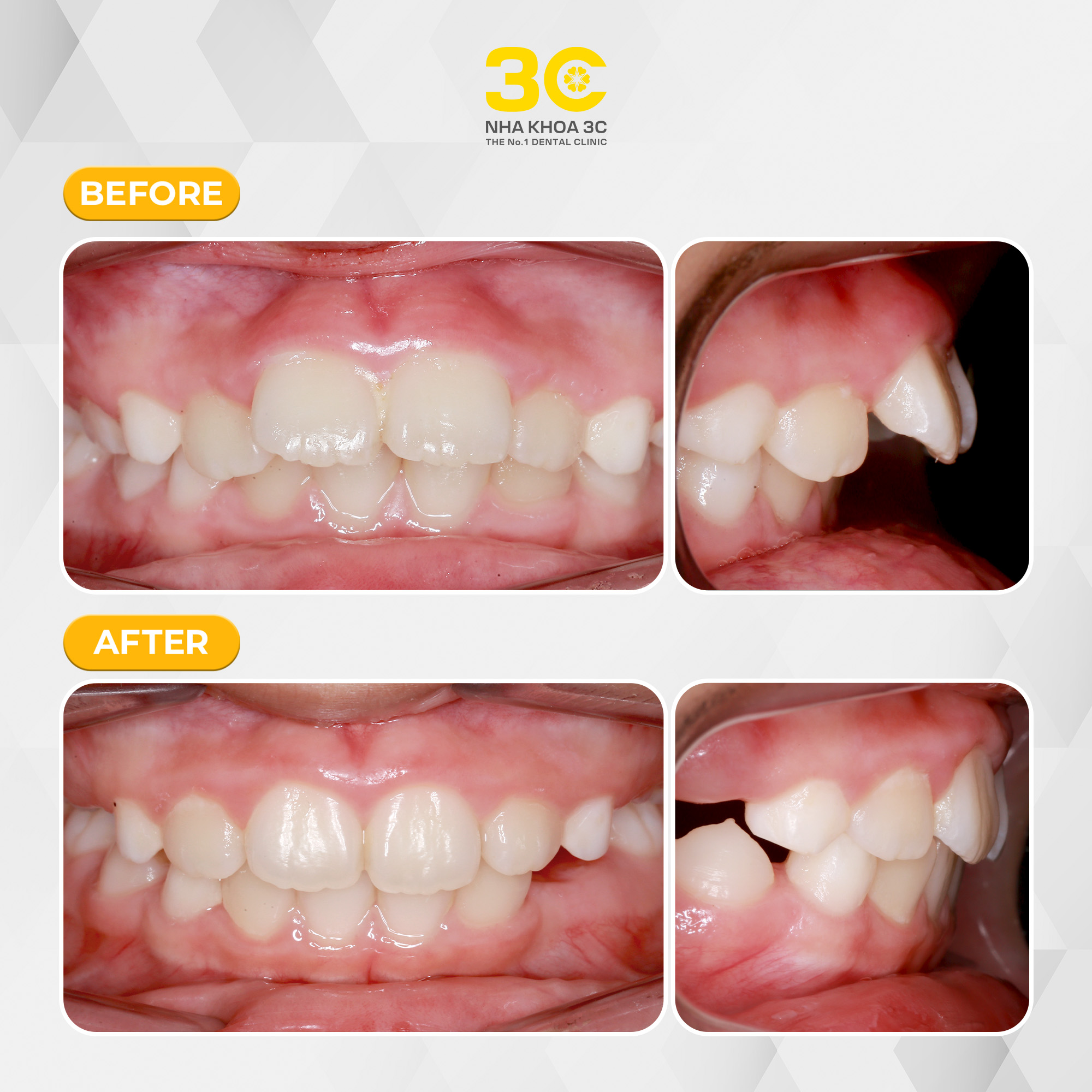 NHA KHOA 3C - DỊCH VỤ NHA KHOA UY TÍN TẠI TPHCM