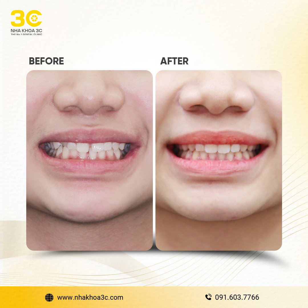 NHA KHOA 3C - DỊCH VỤ NHA KHOA UY TÍN TẠI TPHCM