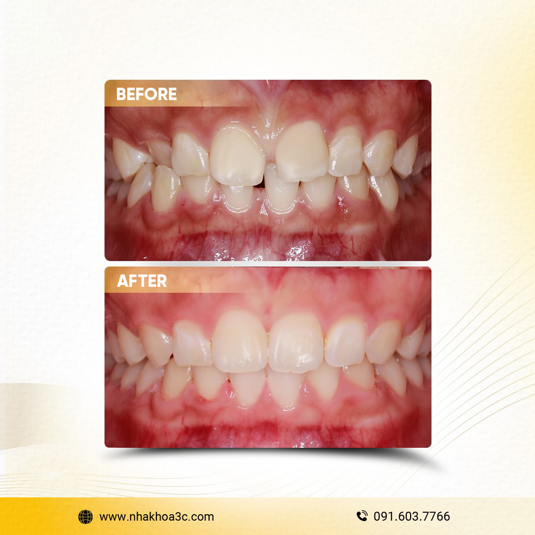 NHA KHOA 3C - DỊCH VỤ NHA KHOA UY TÍN TẠI TPHCM