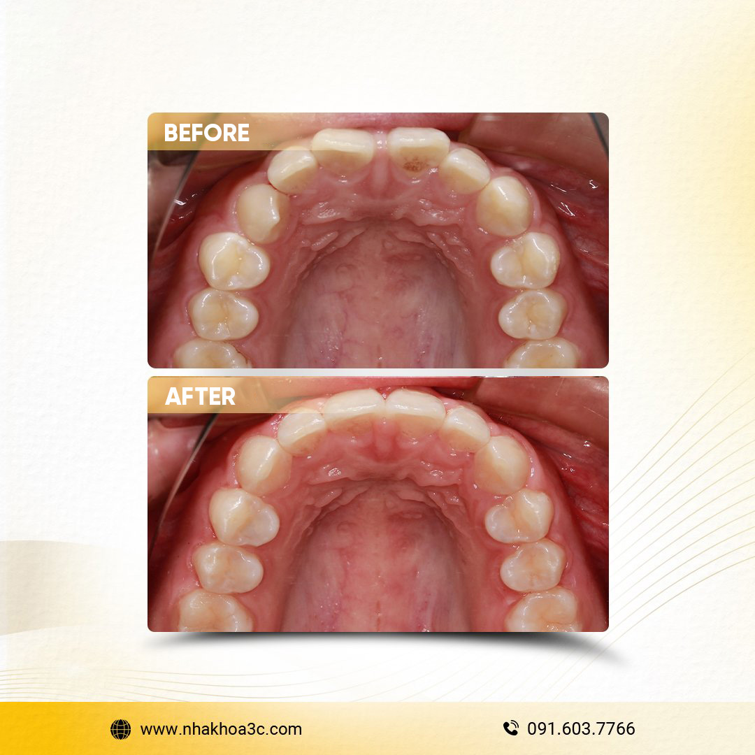 NHA KHOA 3C - DỊCH VỤ NHA KHOA UY TÍN TẠI TPHCM