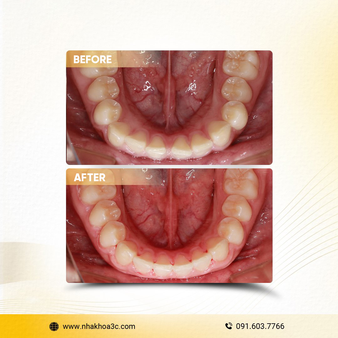 NHA KHOA 3C - DỊCH VỤ NHA KHOA UY TÍN TẠI TPHCM