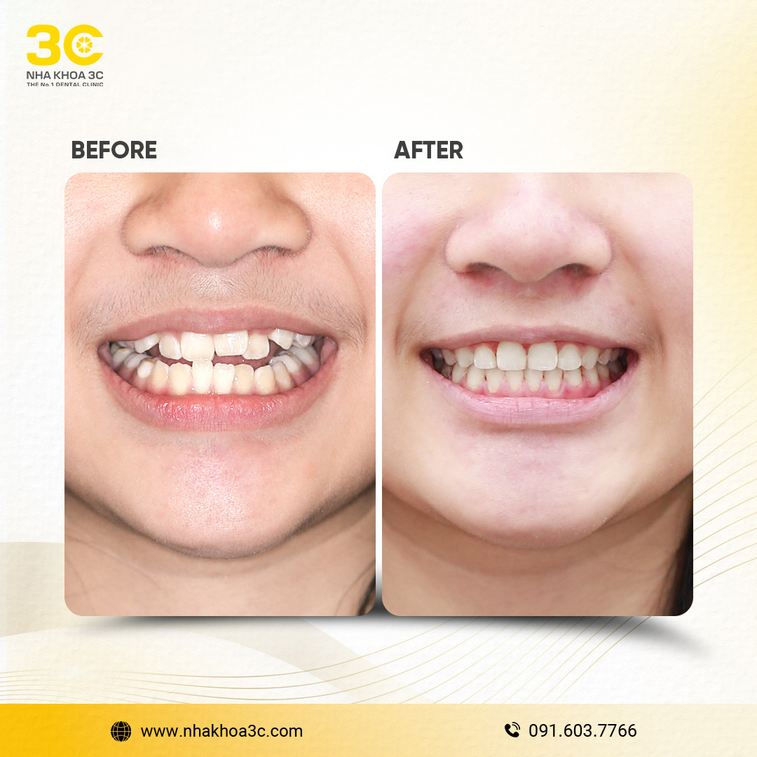 NHA KHOA 3C - DỊCH VỤ NHA KHOA UY TÍN TẠI TPHCM