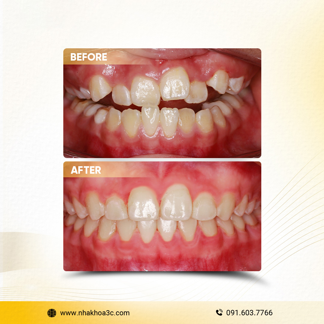 NHA KHOA 3C - DỊCH VỤ NHA KHOA UY TÍN TẠI TPHCM