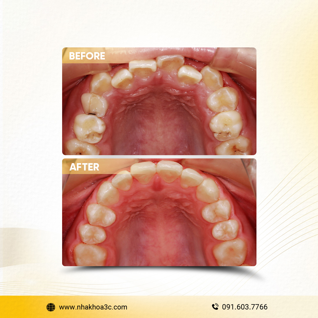 NHA KHOA 3C - DỊCH VỤ NHA KHOA UY TÍN TẠI TPHCM
