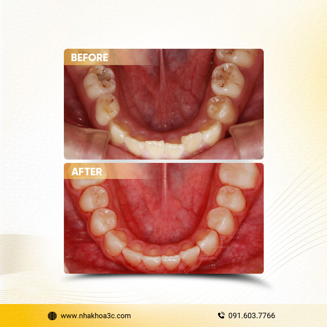 NHA KHOA 3C - DỊCH VỤ NHA KHOA UY TÍN TẠI TPHCM