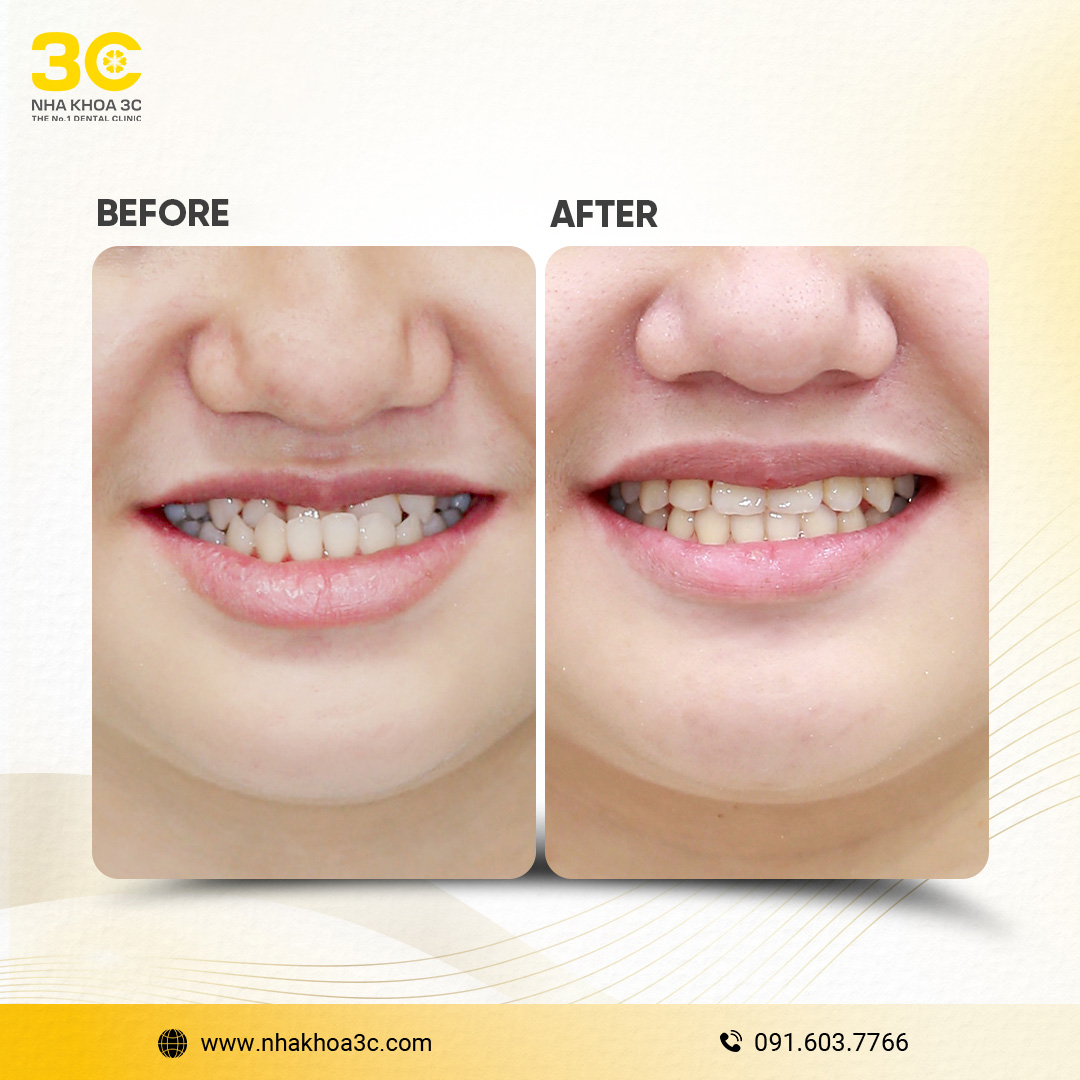 NHA KHOA 3C - DỊCH VỤ NHA KHOA UY TÍN TẠI TPHCM