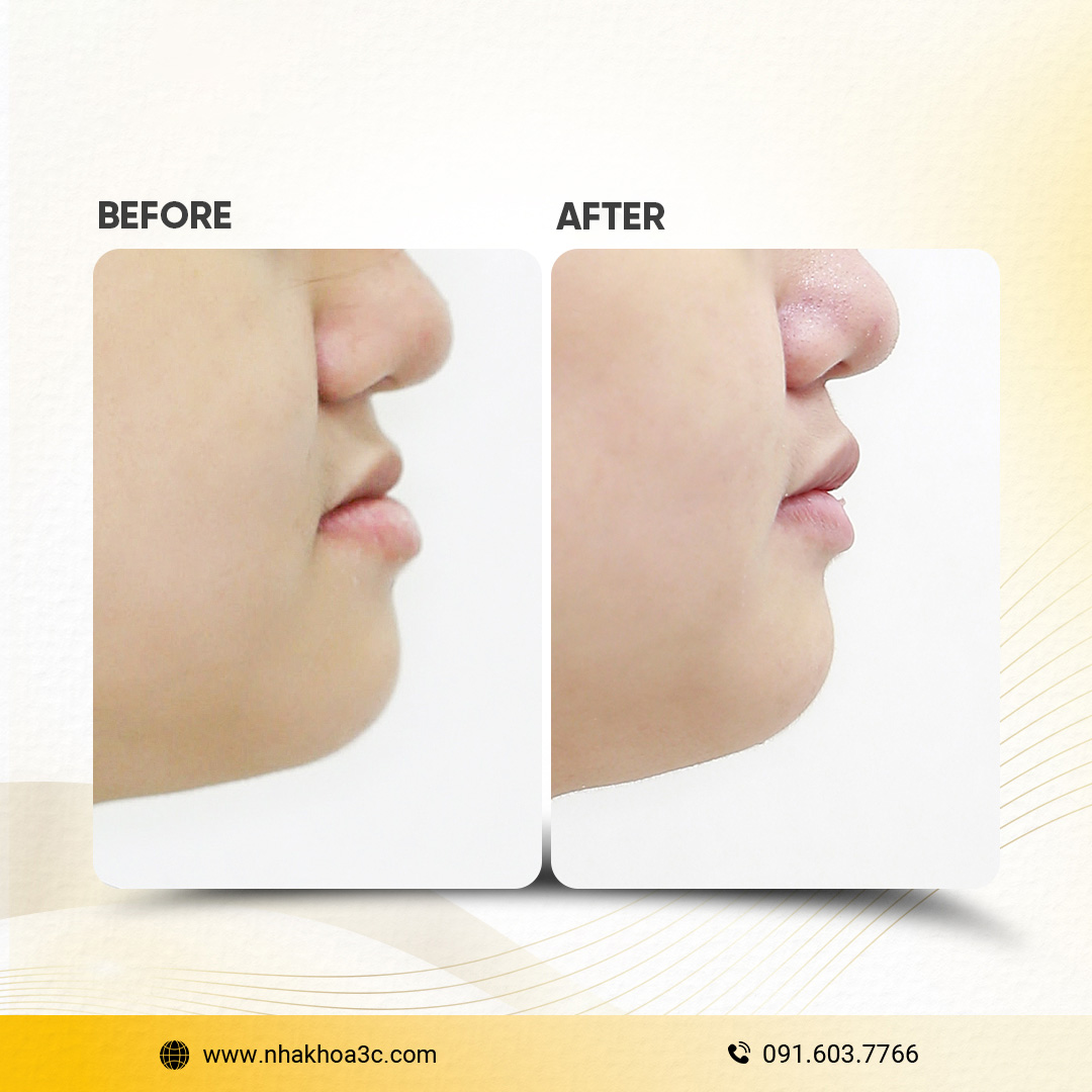 NHA KHOA 3C - DỊCH VỤ NHA KHOA UY TÍN TẠI TPHCM