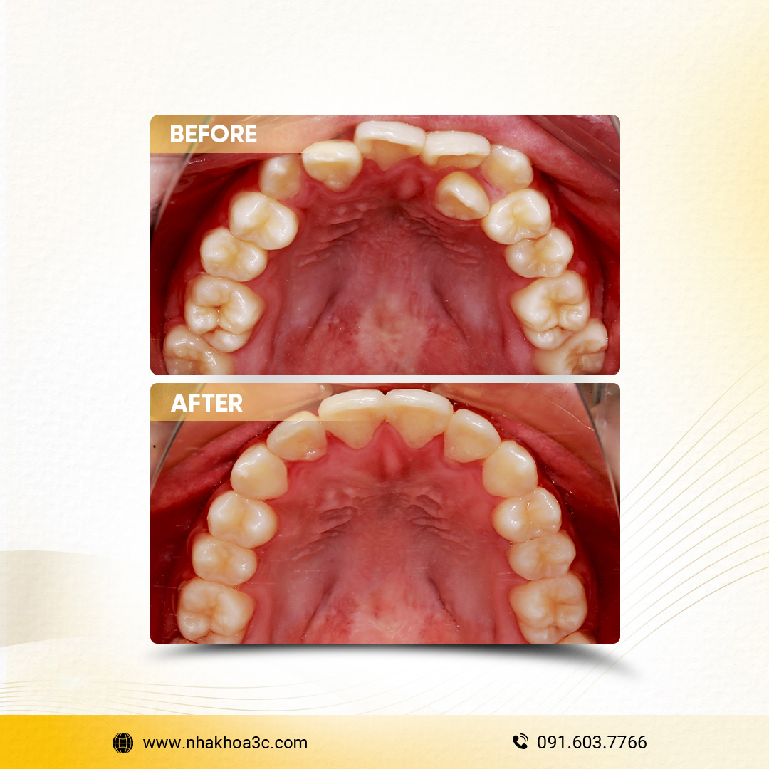 NHA KHOA 3C - DỊCH VỤ NHA KHOA UY TÍN TẠI TPHCM