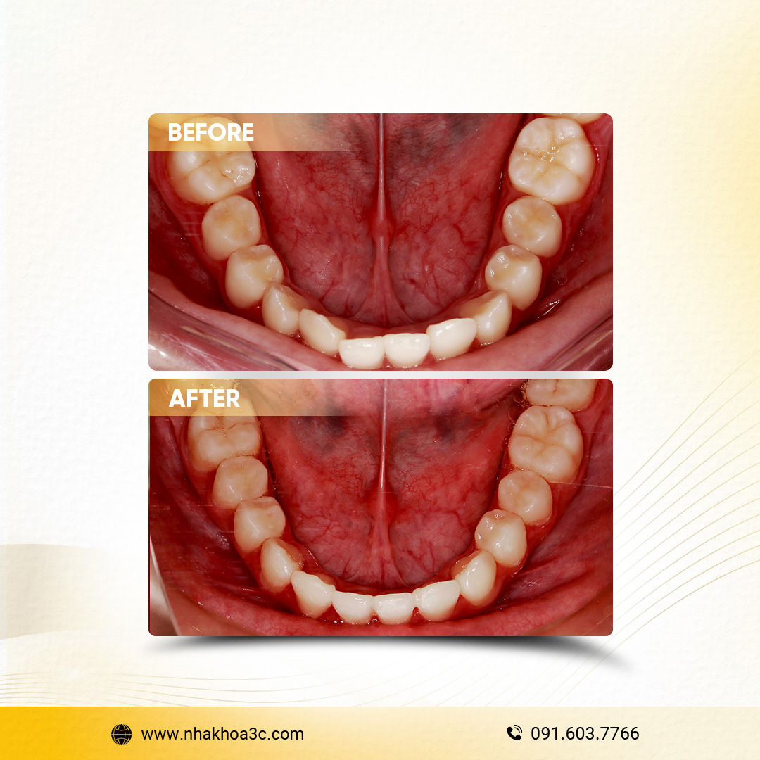 NHA KHOA 3C - DỊCH VỤ NHA KHOA UY TÍN TẠI TPHCM