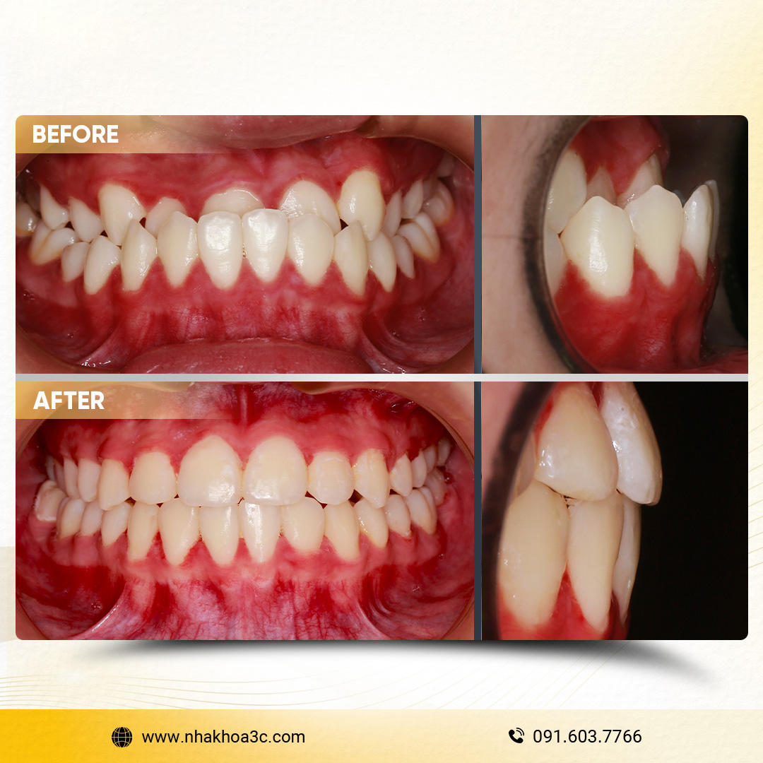 NHA KHOA 3C - DỊCH VỤ NHA KHOA UY TÍN TẠI TPHCM