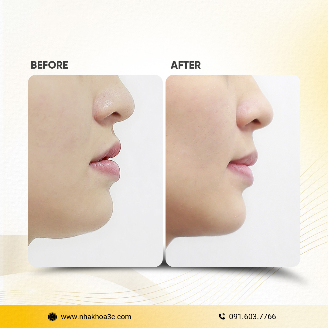 NHA KHOA 3C - DỊCH VỤ NHA KHOA UY TÍN TẠI TPHCM