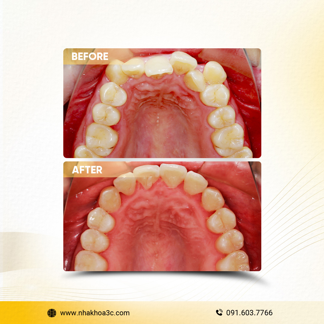 NHA KHOA 3C - DỊCH VỤ NHA KHOA UY TÍN TẠI TPHCM