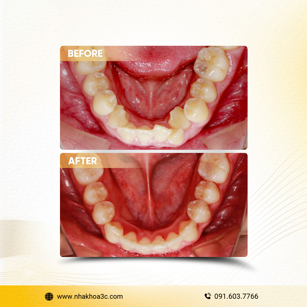 NHA KHOA 3C - DỊCH VỤ NHA KHOA UY TÍN TẠI TPHCM