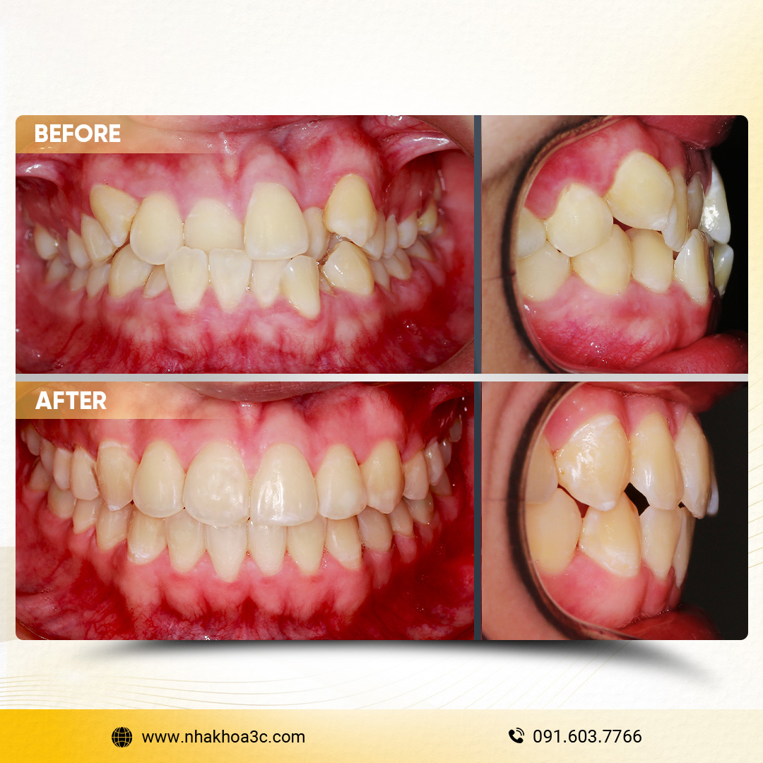 NHA KHOA 3C - DỊCH VỤ NHA KHOA UY TÍN TẠI TPHCM