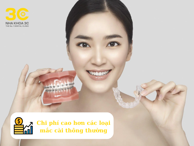 Chi phí niềng răng trong suốt cao hơn các loại mắc cài thông thường