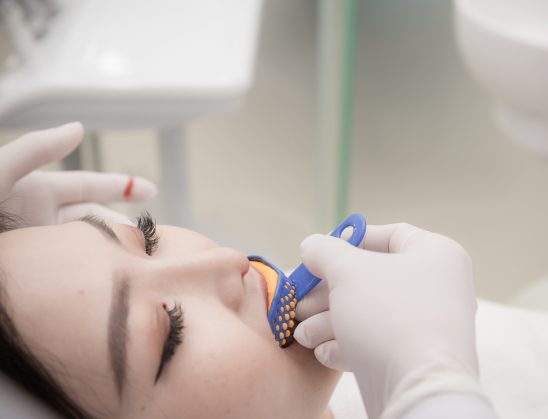 Porcelain Veneers - Nha Khoa 3C