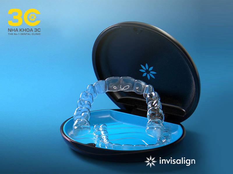 Khay niềng invisalign- phương pháp niềng răng trong suốt hiện đại, khay niềng thiết kế cá nhân hóa