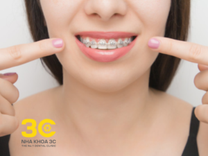 25 tuổi có niềng răng được không? – Câu trả lời là hoàn toàn có thể và vẫn đem lại hiệu quả tốt.