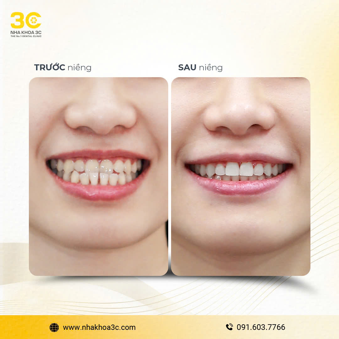 NHA KHOA 3C - DỊCH VỤ NHA KHOA UY TÍN TẠI TPHCM