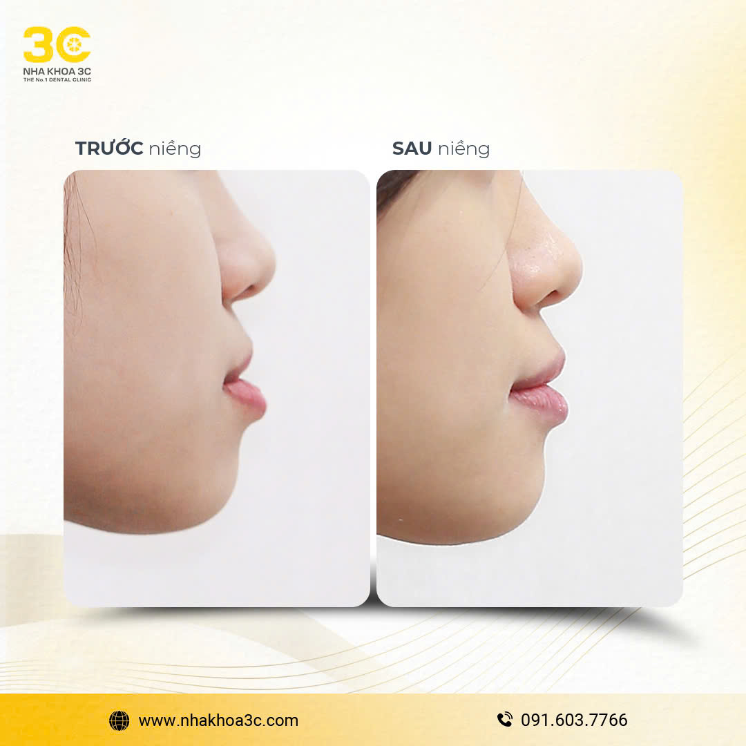 NHA KHOA 3C - DỊCH VỤ NHA KHOA UY TÍN TẠI TPHCM