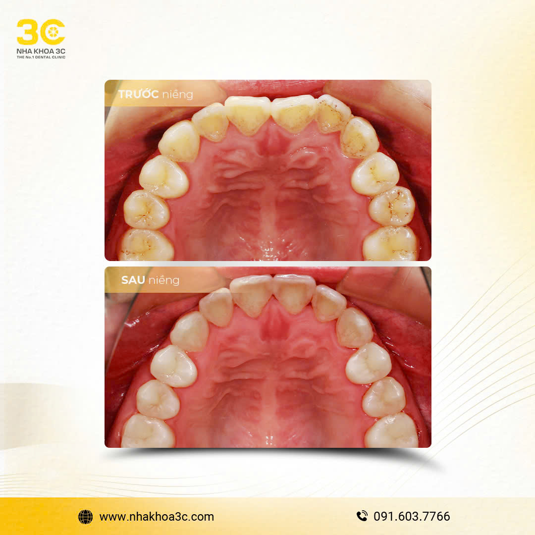 NHA KHOA 3C - DỊCH VỤ NHA KHOA UY TÍN TẠI TPHCM