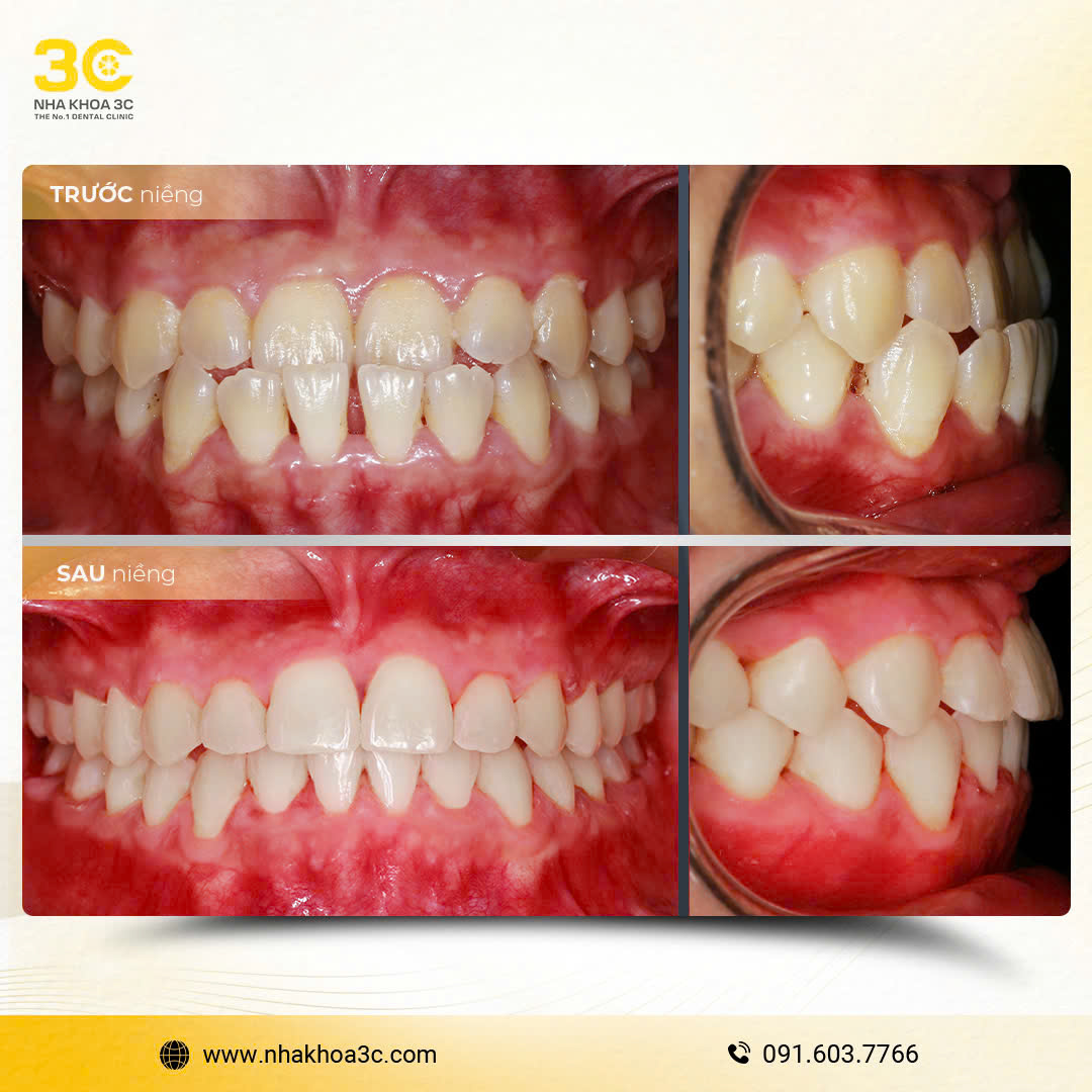 NHA KHOA 3C - DỊCH VỤ NHA KHOA UY TÍN TẠI TPHCM