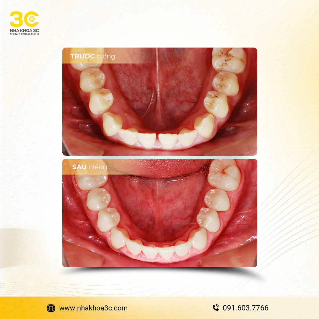 NHA KHOA 3C - DỊCH VỤ NHA KHOA UY TÍN TẠI TPHCM