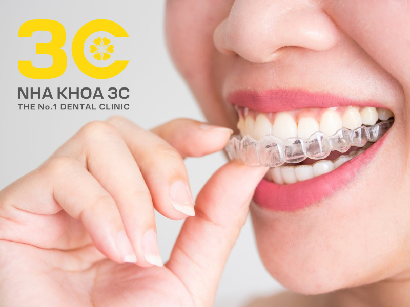 khay niềng răng trong suốt