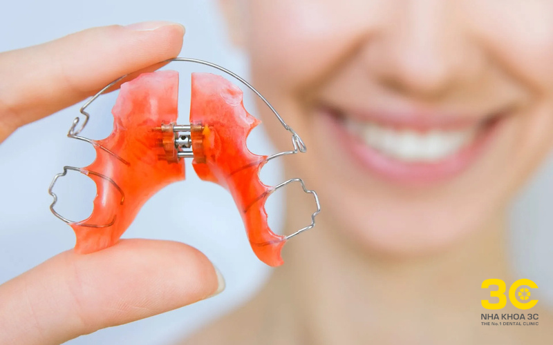 Hàm duy trì phải đeo trong bao lâu