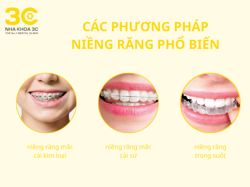 phuong-phap-nieng-rang