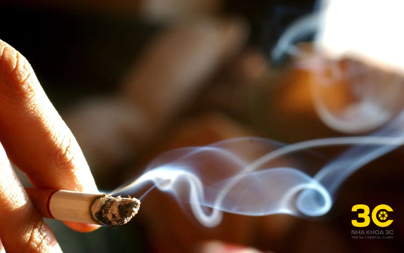 Dây thun niềng răng bị vàng có thể do bạn hút thuốc lá