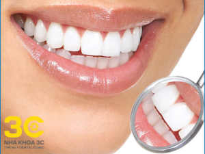 Tẩy trắng răng giá bao nhiêu?