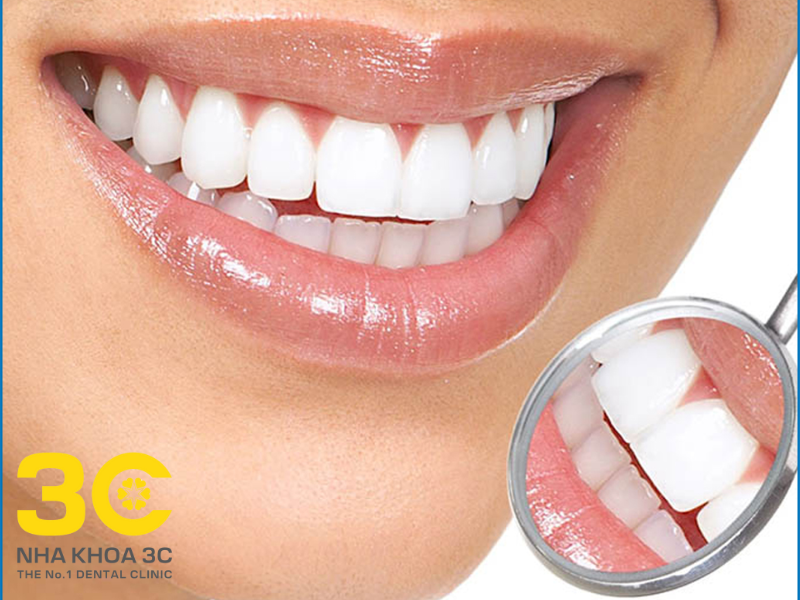 Chế độ ăn uống lành mạnh và vệ sinh răng miệng đúng cách giúp răng luôn trắng bóng
