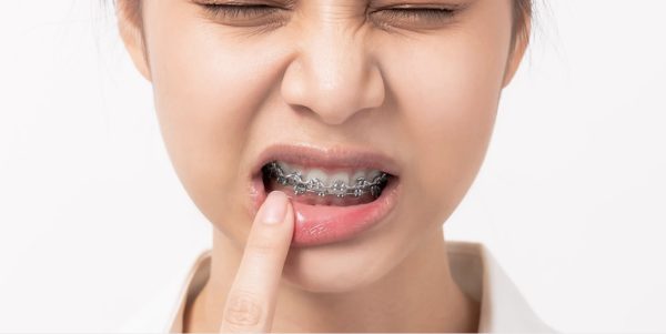 nieng-rang-bao-lau-thi-an-com-duoc