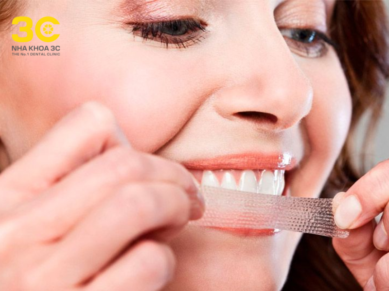 Lạm dụng miếng dán tẩy trắng răng có nhiều hậu uqar tiềm ẩn